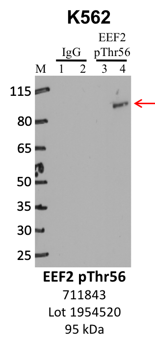 ThermoFisher_711843_1954520_EEF2%20pThr56.png<br>Caption: IP-WB analysis of K562 whole cell lysate using the EEF2 pThr56 specific antibody, 711843. Lanes 1 and 3 are 2.5% of five million whole cell lysate input. Lanes 2 and 4 are 50% of IP enrichment from five million whole cell lysate using normal IgG antibody and the EEF2 pThr56-specific antibody, 711843. The same antibody was used to detect protein levels via Western blot. This antibody passes preliminary validation and will be further pursued for secondary validation. *NOTE* Protein sizes are taken from Genecards.org and are only estimates based on sequence. Actual protein size may differ based on protein characteristics and electrophoresis method used.