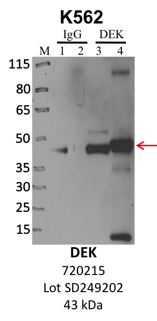 ThermoFisher_720215_SD249202_DEK.png<br>Caption: IP-WB analysis of K562 whole cell lysate using the DEK specific antibody, 720215. Lanes 1 and 3 are 2.5% of five million whole cell lysate input. Lanes 2 and 4 are 50% of IP enrichment from five million whole cell lysate using normal IgG antibody and the DEK-specific antibody, 720215. The same antibody was used to detect protein levels via Western blot. This antibody passes preliminary validation and will be further pursued for secondary validation. *NOTE* Protein sizes are taken from Genecards.org and are only estimates based on sequence. Actual protein size may differ based on protein characteristics and electrophoresis method used.