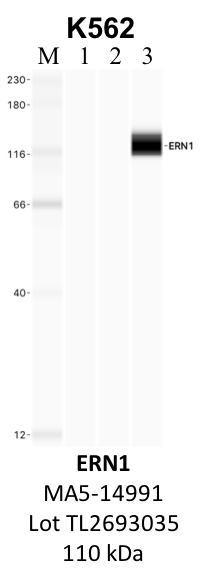 ThermoFisher_MA5-14991_TL2693035_ERN1.png<br>Caption: IP-WB analysis of K562 whole cell lysate using the ERN1 specific antibody, MA5-14991. Lane 1 is 2.5% of five million whole cell lysate input. Lanes 2 and 3 are 50% of IP enrichment from five million whole cell lysate using normal IgG antibody and the ERN1-specific antibody, MA5-14991. The same antibody was used to detect protein levels via Western blot. This antibody passes preliminary validation and will be further pursued for secondary validation. *NOTE* Protein sizes are taken from Genecards.org and are only estimates based on sequence. Actual protein size may differ based on protein characteristics and electrophoresis method used.