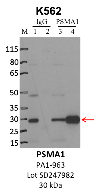 ThermoFisher_PA1-963_SD247982_PSMA1.png<br>Caption: IP-WB analysis of K562 whole cell lysate using the PSMA1 specific antibody, PA1-963. Lanes 1 and 3 are 2.5% of five million whole cell lysate input. Lanes 2 and 4 are 50% of IP enrichment from five million whole cell lysate using normal IgG antibody and the PSMA1-specific antibody, PA1-963. The same antibody was used to detect protein levels via Western blot. This antibody passes preliminary validation and will be further pursued for secondary validation. *NOTE* Protein sizes are taken from Genecards.org and are only estimates based on sequence. Actual protein size may differ based on protein characteristics and electrophoresis method used.