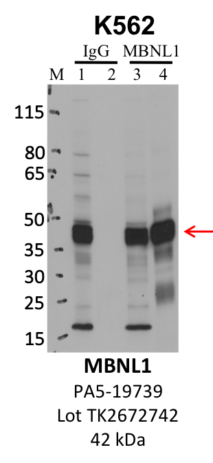 ThermoFisher_PA5-19739_TK2672742_MBNL1.png<br>Caption: IP-WB analysis of K562 whole cell lysate using the MBNL1 specific antibody, PA5-19739. Lanes 1 and 3 are 2.5% of five million whole cell lysate input. Lanes 2 and 4 are 50% of IP enrichment from five million whole cell lysate using normal IgG antibody and the MBNL1-specific antibody, PA5-19739. The same antibody was used to detect protein levels via Western blot. This antibody passes preliminary validation and will be further pursued for secondary validation. *NOTE* Protein sizes are taken from Genecards.org and are only estimates based on sequence. Actual protein size may differ based on protein characteristics and electrophoresis method used.