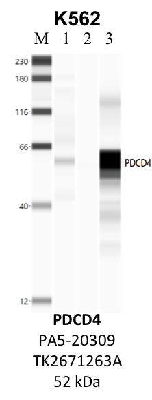 ThermoFisher_PA5-20309_TK2671263A_PDCD4.png<br>Caption: IP-WB analysis of K562 whole cell lysate using the PDCD4 specific antibody, PA5-20309. Lanes 1 and 2 are 2.5% of five million whole cell lysate input and 50% of IP enrichment, respectively, using a normal IgG antibody. Lane 3 is 50% of IP enrichment from five million whole cell lysate using the PDCD4-specific antibody, PA5-20309. The same antibody was used to detect protein levels via Western blot. This antibody passes preliminary validation and will be further pursued for secondary validation. *NOTE* Protein sizes are taken from Genecards.org and are only estimates based on sequence. Actual protein size may differ based on protein characteristics and electrophoresis method used.