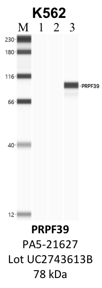 ThermoFisher_PA5-21627_UC2743613B_PRPF39.png<br>Caption: IP-WB analysis of K562 whole cell lysate using the PRPF39 specific antibody, PA5-21627. Lanes 1 and 2 are 2.5% of five million whole cell lysate input and 50% of IP enrichment, respectively, using a normal IgG antibody. Lane 3 is 50% of IP enrichment from five million whole cell lysate using the PRPF39-specific antibody, PA5-21627. The same antibody was used to detect protein levels via Western blot. This antibody passes preliminary validation and will be further pursued for secondary validation. *NOTE* Protein sizes are taken from Genecards.org and are only estimates based on sequence. Actual protein size may differ based on protein characteristics and electrophoresis method used.