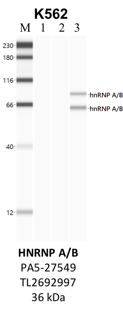 ThermoFisher_PA5-27549_TL2692997_HNRNPAB.png<br>Caption: IP-WB analysis of K562 whole cell lysate using the HNRNPAB specific antibody, PA5-27549. Lane 1 is 2.5% of five million whole cell lysate input. Lanes 2 and 3 are 50% of IP enrichment from five million whole cell lysate using normal IgG antibody and the HNRNPAB-specific antibody, PA5-27549. The same antibody was used to detect protein levels via Western blot. This antibody passes preliminary validation and will be further pursued for secondary validation. *NOTE* Protein sizes are taken from Genecards.org and are only estimates based on sequence. Actual protein size may differ based on protein characteristics and electrophoresis method used.