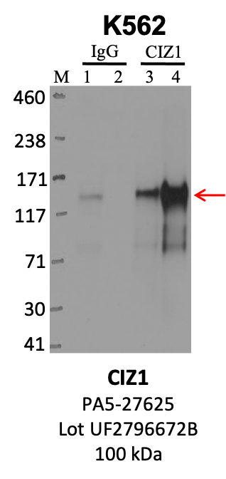 ThermoFisher_PA5-27625_UF2796672B_CIZ1.png<br>Caption: IP-WB analysis of K562 whole cell lysate using the CIZ1 specific antibody, PA5-27625. Lanes 1 and 3 are 2.5% of five million whole cell lysate input. Lanes 2 and 4 are 50% of IP enrichment from five million whole cell lysate using normal IgG antibody and the CIZ1-specific antibody, PA5-27625. The same antibody was used to detect protein levels via Western blot. This antibody passes preliminary validation and will be further pursued for secondary validation. *NOTE* Protein sizes are taken from Genecards.org and are only estimates based on sequence. Actual protein size may differ based on protein characteristics and electrophoresis method used.