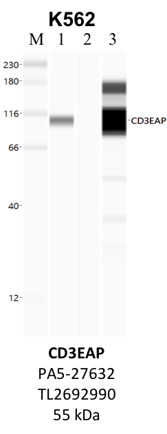 ThermoFisher_PA5-27632_TL2692990_CD3EAP.png<br>Caption: IP-WB analysis of K562 whole cell lysate using the CD3EAP specific antibody, PA5-27632. Lane 1 is 2.5% of five million whole cell lysate input. Lanes 2 and 3 are 50% of IP enrichment from five million whole cell lysate using normal IgG antibody and the CD3EAP-specific antibody, PA5-27632. The same antibody was used to detect protein levels via Western blot. This antibody passes preliminary validation and will be further pursued for secondary validation. *NOTE* Protein sizes are taken from Genecards.org and are only estimates based on sequence. Actual protein size may differ based on protein characteristics and electrophoresis method used.