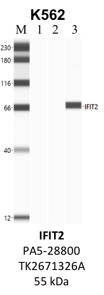 ThermoFisher_PA5-28800_TK2671326A_IFIT2.png<br>Caption: IP-WB analysis of K562 whole cell lysate using the IFIT2 specific antibody, PA5-28800. Lane 1 is 2.5% of five million whole cell lysate input. Lanes 2 and 3 are 50% of IP enrichment from five million whole cell lysate using normal IgG antibody and the IFIT2-specific antibody, PA5-28800. The same antibody was used to detect protein levels via Western blot. This antibody passes preliminary validation and will be further pursued for secondary validation. *NOTE* Protein sizes are taken from Genecards.org and are only estimates based on sequence. Actual protein size may differ based on protein characteristics and electrophoresis method used.