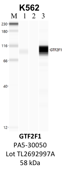 ThermoFisher_PA5-30050_TL2692997A_GTF2F1.png<br>Caption: IP-WB analysis of K562 whole cell lysate using the GTF2F1 specific antibody, PA5-30050. Lanes 1 and 2 are 2.5% of five million whole cell lysate input and 50% of IP enrichment, respectively, using a normal IgG antibody. Lane 3 is 50% of IP enrichment from five million whole cell lysate using the GTF2F1-specific antibody, PA5-30050. The same antibody was used to detect protein levels via Western blot. This antibody passes preliminary validation and will be further pursued for secondary validation. *NOTE* Protein sizes are taken from Genecards.org and are only estimates based on sequence. Actual protein size may differ based on protein characteristics and electrophoresis method used.