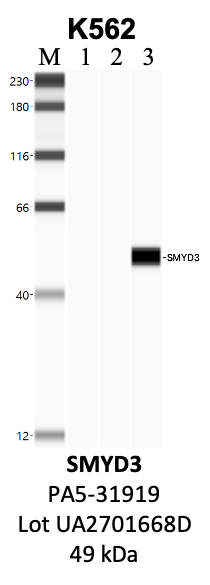 ThermoFisher_PA5-31919_UA2701668D_SMYD3.png<br>Caption: IP-WB analysis of K562 whole cell lysate using the NUP35 specific antibody, A301-781A. Lanes 1 and 3 are 2.5% of five million whole cell lysate input. Lanes 2 and 4 are 50% of IP enrichment from five million whole cell lysate using normal IgG antibody and the NUP35-specific antibody, A301-781A. The same antibody was used to detect protein levels via Western blot. This antibody passes preliminary validation and will be further pursued for secondary validation. *NOTE* Protein sizes are taken from Genecards.org and are only estimates based on sequence. Actual protein size may differ based on protein characteristics and electrophoresis method used.