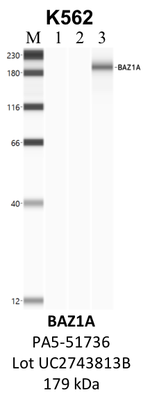 ThermoFisher_PA5-51736_UC2743813B_BAZ1A.png<br>Caption: IP-WB analysis of K562 whole cell lysate using the BAZ1A specific antibody, PA5-51736. Lanes 1 and 2 are 2.5% of five million whole cell lysate input and 50% of IP enrichment, respectively, using a normal IgG antibody. Lane 3 is 50% of IP enrichment from five million whole cell lysate using the BAZ1A-specific antibody, PA5-51736. The same antibody was used to detect protein levels via Western blot. This antibody passes preliminary validation and will be further pursued for secondary validation. *NOTE* Protein sizes are taken from Genecards.org and are only estimates based on sequence. Actual protein size may differ based on protein characteristics and electrophoresis method used.