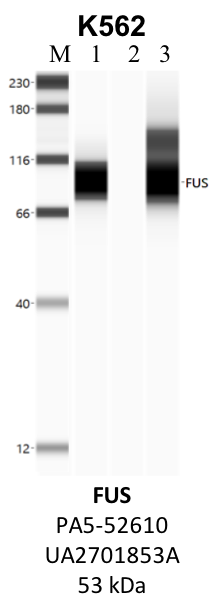 ThermoFisher_PA5-52610_UA2701853A_FUS.png<br>Caption: IP-WB analysis of K562 whole cell lysate using the FUS specific antibody, PA5-52610. Lane 1 is 2.5% of five million whole cell lysate input. Lanes 2 and 3 are 50% of IP enrichment from five million whole cell lysate using normal IgG antibody and the FUS-specific antibody, PA5-52610. The same antibody was used to detect protein levels via Western blot. This antibody passes preliminary validation and will be further pursued for secondary validation. *NOTE* Protein sizes are taken from Genecards.org and are only estimates based on sequence. Actual protein size may differ based on protein characteristics and electrophoresis method used.