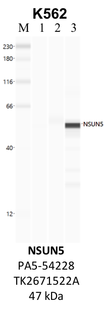 ThermoFisher_PA5-54228_TK2671522A_NSUN5.png<br>Caption: IP-WB analysis of K562 whole cell lysate using the NSUN5 specific antibody, PA5-54228. Lanes 1 and 3 are 2.5% of five million whole cell lysate input. Lanes 2 and 4 are 50% of IP enrichment from five million whole cell lysate using normal IgG antibody and the NSUN5-specific antibody, PA5-54228. The same antibody was used to detect protein levels via Western blot. This antibody passes preliminary validation and will be further pursued for secondary validation. *NOTE* Protein sizes are taken from Genecards.org and are only estimates based on sequence. Actual protein size may differ based on protein characteristics and electrophoresis method used.