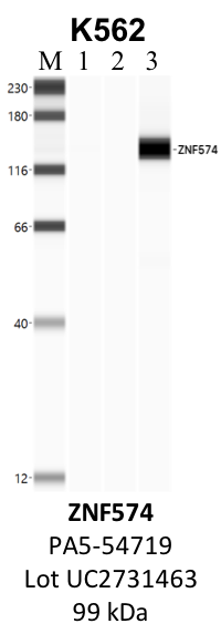 ThermoFisher_PA5-54719_UC2731463_ZNF574.png<br>Caption: IP-WB analysis of K562 whole cell lysate using the ZNF574 specific antibody, PA5-54719. Lane 1 is 2.5% of five million whole cell lysate input. Lanes 2 and 3 are 50% of IP enrichment from five million whole cell lysate using normal IgG antibody and the ZNF574-specific antibody, PA5-54719. The same antibody was used to detect protein levels via Western blot. This antibody passes preliminary validation and will be further pursued for secondary validation. *NOTE* Protein sizes are taken from Genecards.org and are only estimates based on sequence. Actual protein size may differ based on protein characteristics and electrophoresis method used.