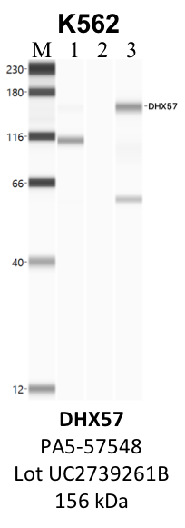 ThermoFisher_PA5-57548_UC2739261B_DHX57.png<br>Caption: IP-WB analysis of K562 whole cell lysate using the DHX57 specific antibody, PA5-57548. Lane 1 is 2.5% of five million whole cell lysate input. Lanes 2 and 3 are 50% of IP enrichment from five million whole cell lysate using normal IgG antibody and the DHX57-specific antibody, PA5-57548. The same antibody was used to detect protein levels via Western blot. This antibody passes preliminary validation and will be further pursued for secondary validation. *NOTE* Protein sizes are taken from Genecards.org and are only estimates based on sequence. Actual protein size may differ based on protein characteristics and electrophoresis method used.