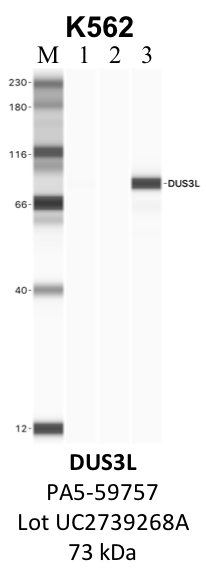 ThermoFisher_PA5-59757_UC2739268A_DUS3L.png<br>Caption: IP-WB analysis of K562 whole cell lysate using the DUS3L specific antibody, PA5-59757. Lane 1 is 2.5% of five million whole cell lysate input. Lanes 2 and 3 are 50% of IP enrichment from five million whole cell lysate using normal IgG antibody and the DUS3L-specific antibody, PA5-59757. The same antibody was used to detect protein levels via Western blot. This antibody passes preliminary validation and will be further pursued for secondary validation. *NOTE* Protein sizes are taken from Genecards.org and are only estimates based on sequence. Actual protein size may differ based on protein characteristics and electrophoresis method used.