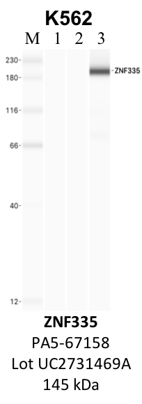 ThermoFisher_PA5-67158_UC2731469A_ZNF335.png<br>Caption: IP-WB analysis of K562 whole cell lysate using the ZNF335 specific antibody, PA5-67158. Lane 1 is 2.5% of five million whole cell lysate input. Lanes 2 and 3 are 50% of IP enrichment from five million whole cell lysate using normal IgG antibody and the ZNF335-specific antibody, PA5-67158. The same antibody was used to detect protein levels via Western blot. This antibody passes preliminary validation and will be further pursued for secondary validation. *NOTE* Protein sizes are taken from Genecards.org and are only estimates based on sequence. Actual protein size may differ based on protein characteristics and electrophoresis method used.