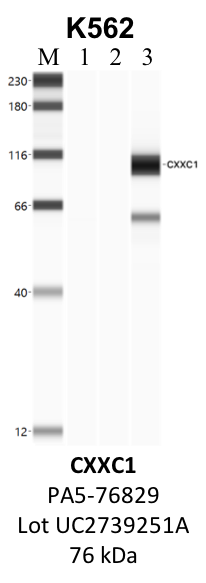 ThermoFisher_PA5-76829_UC2739251A_CXXC1.png<br>Caption: IP-WB analysis of K562 whole cell lysate using the CXXC1 specific antibody, PA5-76829. Lane 1 is 2.5% of five million whole cell lysate input. Lanes 2 and 3 are 50% of IP enrichment from five million whole cell lysate using normal IgG antibody and the CXXC1-specific antibody, PA5-76829. The same antibody was used to detect protein levels via Western blot. This antibody passes preliminary validation and will be further pursued for secondary validation. *NOTE* Protein sizes are taken from Genecards.org and are only estimates based on sequence. Actual protein size may differ based on protein characteristics and electrophoresis method used.