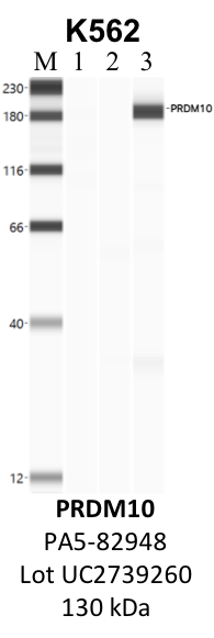 ThermoFisher_PA5-82948_UC2739260_PRDM10.png<br>Caption: IP-WB analysis of K562 whole cell lysate using the PRDM10 specific antibody, PA5-82948. Lane 1 is 2.5% of five million whole cell lysate input. Lanes 2 and 3 are 50% of IP enrichment from five million whole cell lysate using normal IgG antibody and the PRDM10-specific antibody, PA5-82948. The same antibody was used to detect protein levels via Western blot. This antibody passes preliminary validation and will be further pursued for secondary validation. *NOTE* Protein sizes are taken from Genecards.org and are only estimates based on sequence. Actual protein size may differ based on protein characteristics and electrophoresis method used.