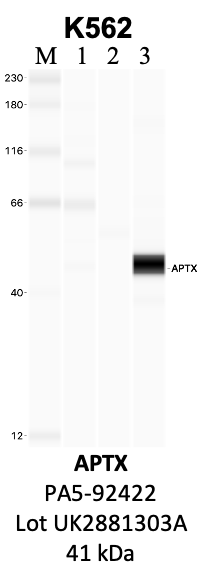 ThermoFisher_PA5-92422_UK2881303A_APTX.png<br>Caption: IP-WB analysis of K562 whole cell lysate using the APTX specific antibody, PA5-92422. Lanes 1 and 2 are 2.5% of five million whole cell lysate input and 50% of IP enrichment, respectively, using a normal IgG antibody. Lane 3 is 50% of IP enrichment from five million whole cell lysate using the APTX-specific antibody, PA5-92422. The same antibody was used to detect protein levels via Western blot. This antibody passes preliminary validation and will be further pursued for secondary validation. *NOTE* Protein sizes are taken from Genecards.org and are only estimates based on sequence. Actual protein size may differ based on protein characteristics and electrophoresis method used.