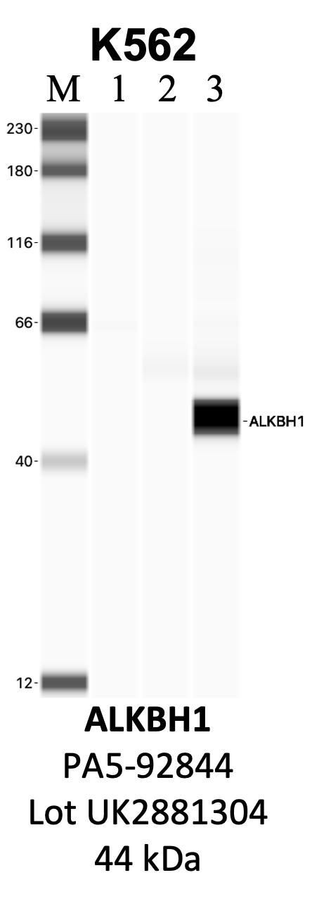 ThermoFisher_PA5-92844_UK2881304_ALKBH1.png<br>Caption: IP-WB analysis of K562 whole cell lysate using the ALKBH1 specific antibody, PA5-92844. Lanes 1 and 2 are 2.5% of five million whole cell lysate input and 50% of IP enrichment, respectively, using a normal IgG antibody. Lane 3 is 50% of IP enrichment from five million whole cell lysate using the ALKBH1-specific antibody, PA5-92844. The same antibody was used to detect protein levels via Western blot. This antibody passes preliminary validation and will be further pursued for secondary validation. *NOTE* Protein sizes are taken from Genecards.org and are only estimates based on sequence. Actual protein size may differ based on protein characteristics and electrophoresis method used.