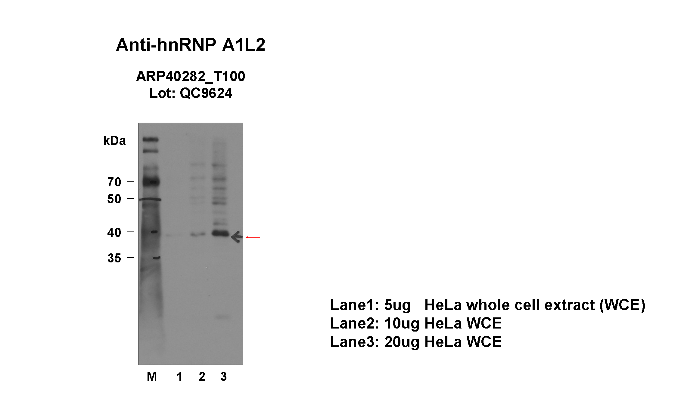 hnRNPA1L2_aviva-1_WB_HeLa_Fu.png<br>Caption: Western blot analysis of lysates from HeLa cells using rabbit polyclonal to HNRNPA1L2