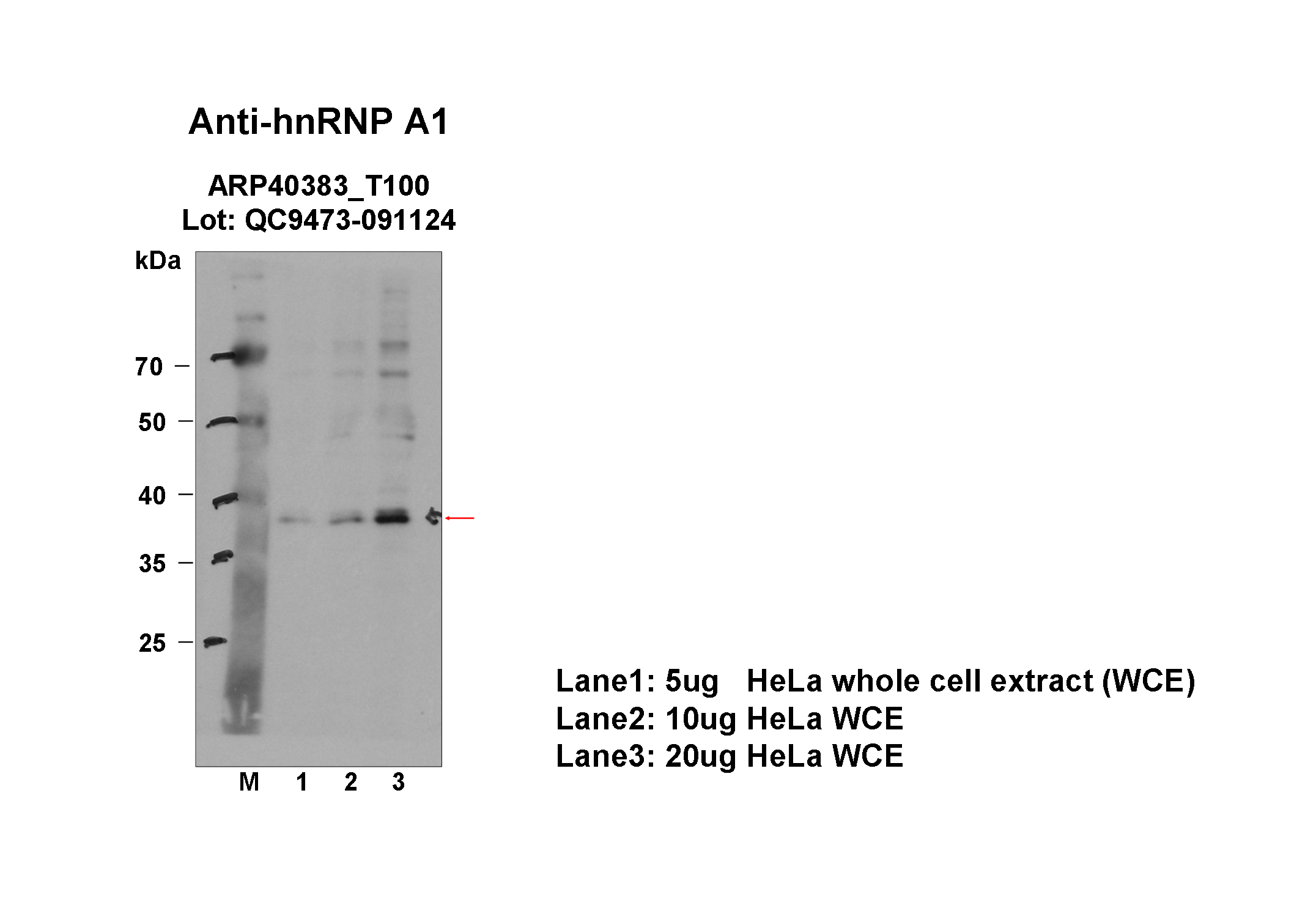 hnRNPA1_aviva-1_WB_HeLa_Fu.png<br>Caption: Western blot analysis of lysates from HeLa cells using rabbit polyclonal to HNRNPA1