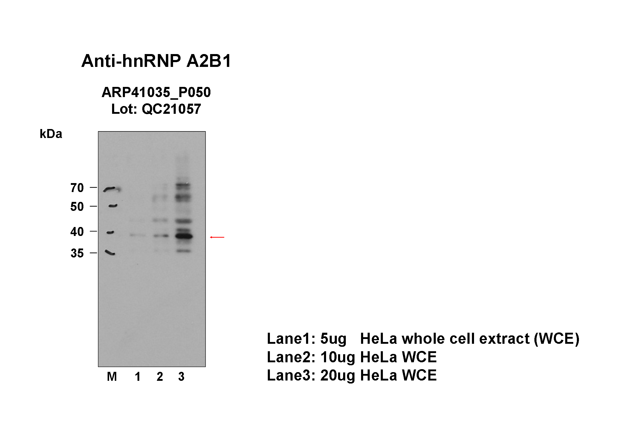 hnRNPA2B1_aviva_WB_HeLa_Fu.png<br>Caption: Western blot analysis of lysates from HeLa cells using rabbit polyclonal to HNRNPA2B1. Expected size: 37kDa