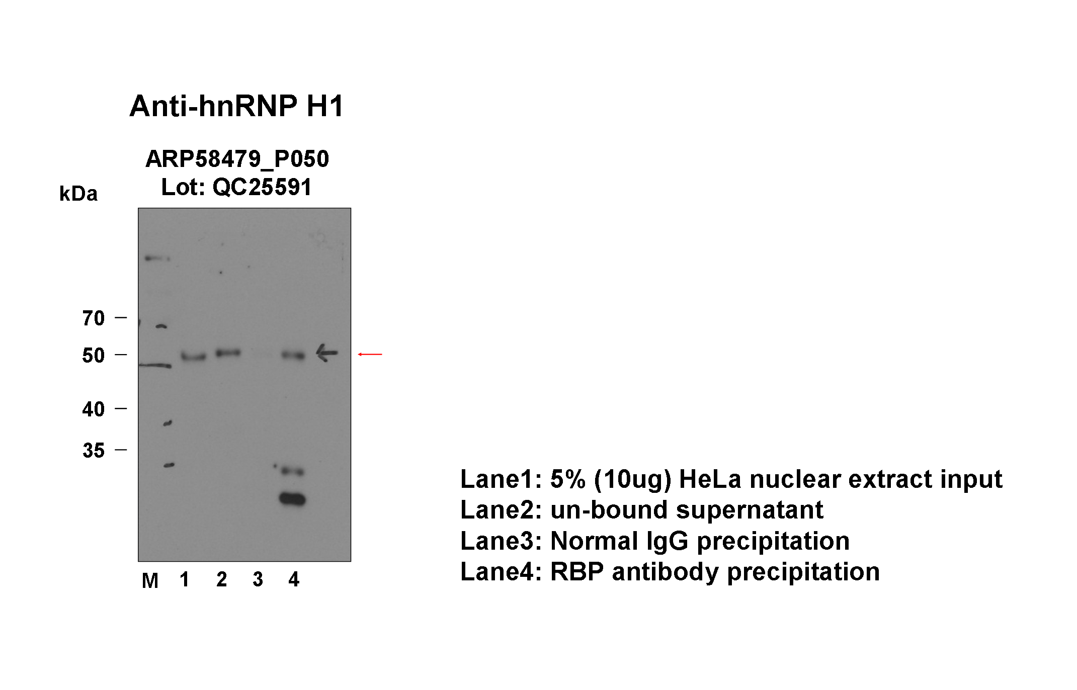 hnRNPH1_aviva_IP-WB_HeLa_Fu.png<br>Caption: Immunoprecipitation from HeLa whole cell lysate and analized by western blot analysis uisng rabbit polyclonal to HNRNPH1