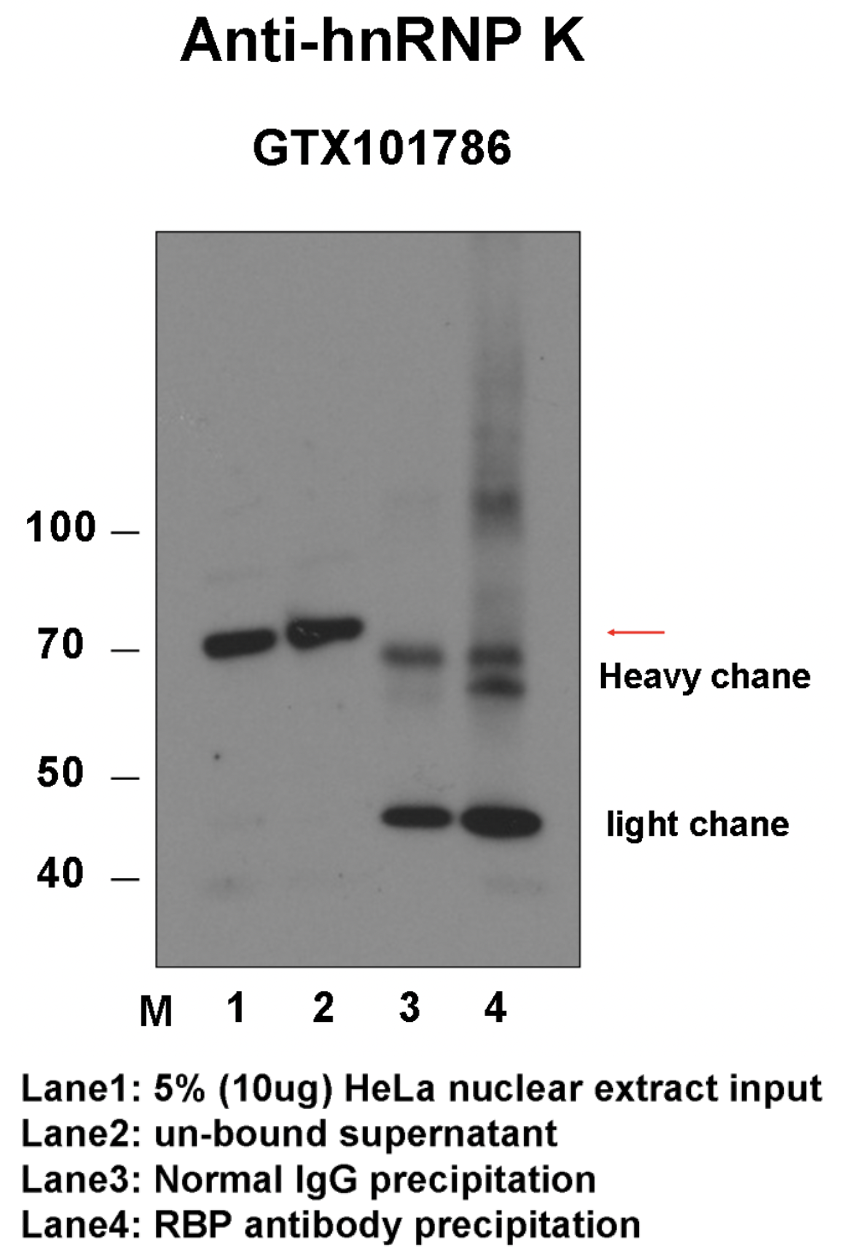 hnRNPK_genetex-1_IP-WB_HeLa_Fu.png<br>Caption: Immunoprecipitation from HeLa whole cell lysate and analized by western blot analysis uisng rabbit polyclonal to HNRNPK