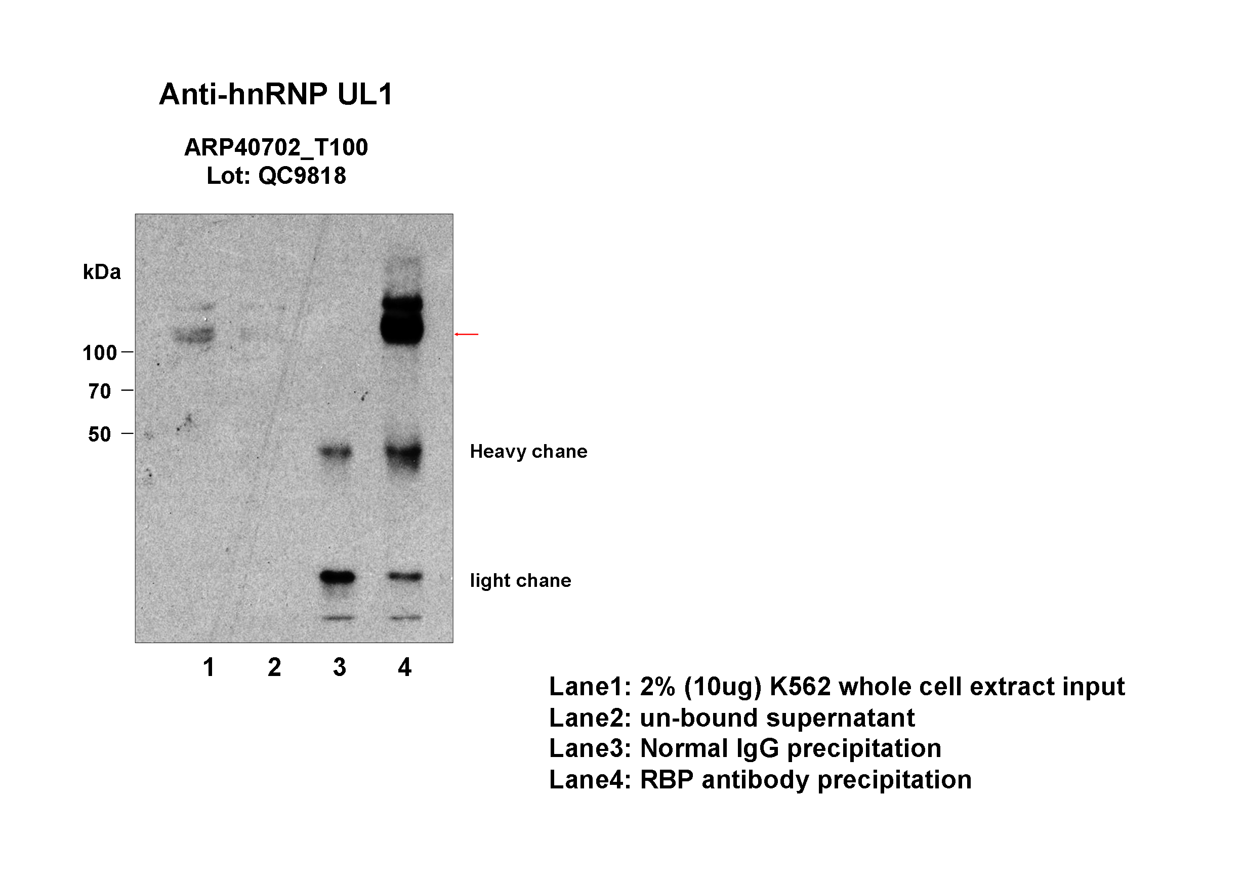 hnRNPUL1_aviva-2_IP-WB_K562_Fu.png<br>Caption: Immunoprecipitation from HeLa whole cell lysate and analized by western blot analysis uisng rabbit polyclonal to HNRPUL1