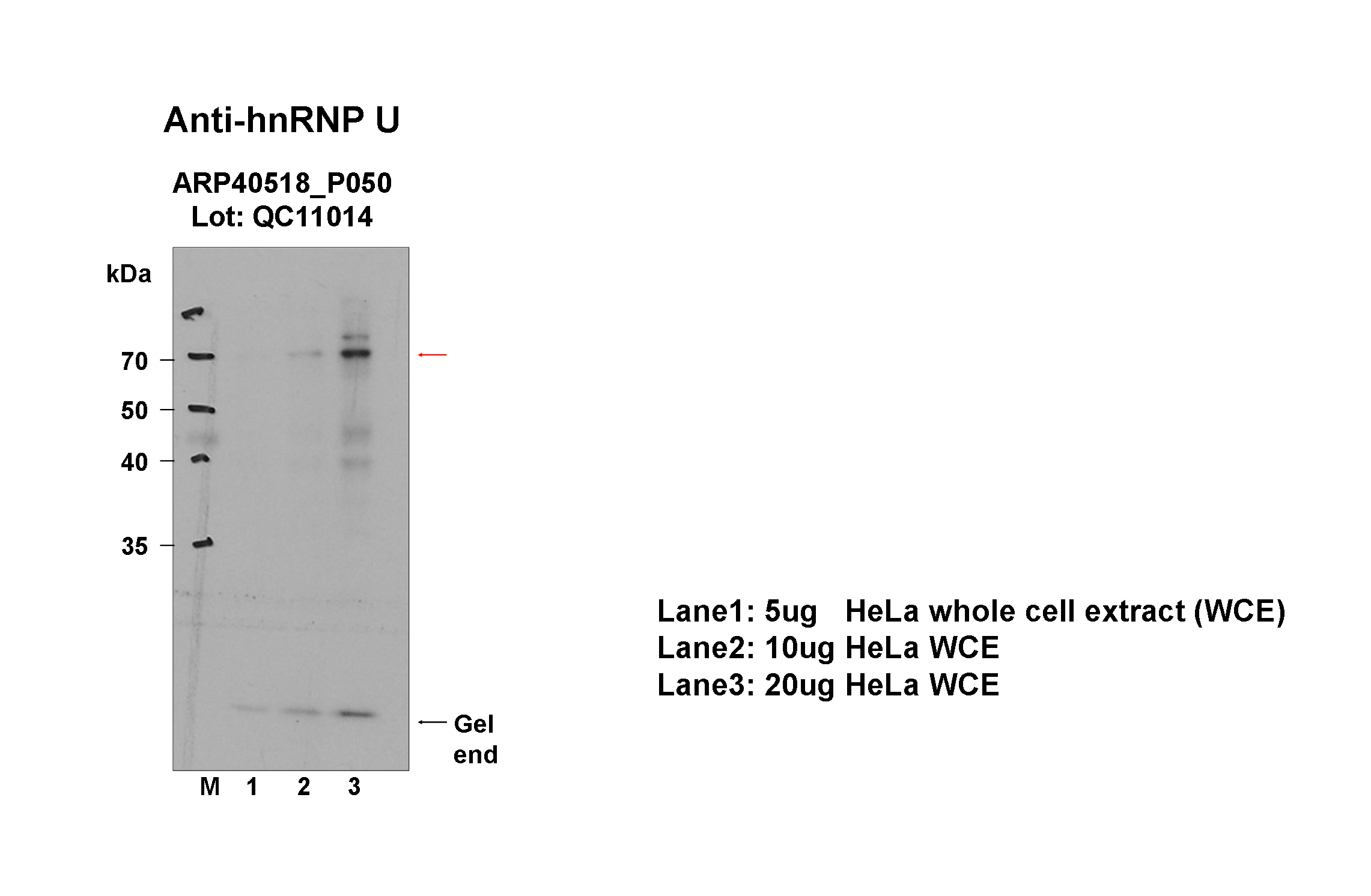 hnRNPU_aviva-1_WB_HeLa_Fu.png<br>Caption: Western blot analysis of lysates from HeLa cells using rabbit polyclonal to HNRNPU