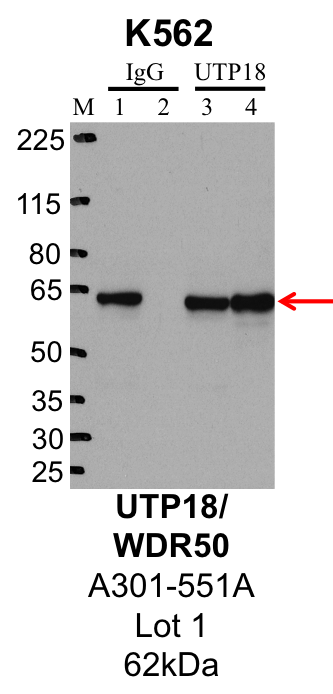 k562_Bethyl_A301-551A_1_UTP18.png<br>Caption: IP-Western Blot analysis of K562 whole cell lysate using UTP18 specific antibody. Lane 1 is 1% of twenty million whole cell lysate input and lane 2 is 25% of IP enrichment using rabbit normal IgG (lanes under 'IgG'). Lane 3 is 1% of twenty million whole cell lysate input and lane 4 is 10% IP enrichment using rabbit polyclonal anti-UTP18 antibody (lanes under 'UTP18').