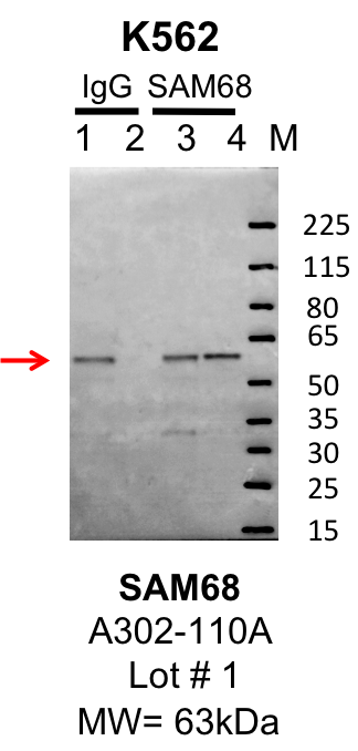 k562_bethyl_A302-110A_1_SAM68.png<br>Caption: IP-Western Blot analysis of K562 whole cell lysate using KHDRBS1/SAM68 specific antibody. Lane 1 is 1% of twenty million whole cell lysate input and lane 2 is 10% of IP enrichment using rabbit normal IgG (lanes under 'IgG'). Lane 3 is 1% of twenty million whole cell lysate input and lane 4 is 10% IP enrichment using rabbit polyclonal anti-SAM68 antibody (lanes under 'SAM68').