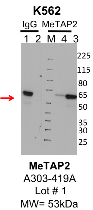 k562_bethyl_A303-419A_1_MeTAP2.png<br>Caption: IP-Western Blot analysis of K562 whole cell lysate using METAP2 specific antibody. Lane 1 is 1% of twenty million whole cell lysate input and lane 2 is 25% of IP enrichment using rabbit normal IgG (lanes under 'IgG'). Lane 3 is 1% of twenty million whole cell lysate input and lane 4 is 10% IP enrichment using rabbit polyclonal anti-METAP2 antibody (lanes under 'METAP2').