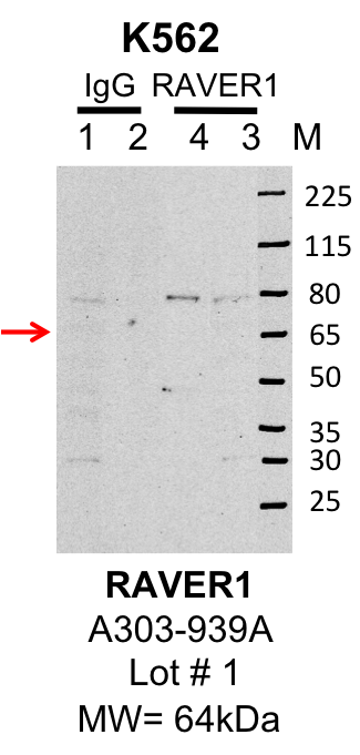 k562_bethyl_A303-939A_1_RAVER1.png<br>Caption: IP-Western Blot analysis of K562 whole cell lysate using RAVER1 specific antibody. Lane 1 is 1% of twenty million whole cell lysate input and lane 2 is 25% of IP enrichment using rabbit normal IgG (lanes under 'IgG'). Lane 3 is 1% of twenty million whole cell lysate input and lane 4 is 10% IP enrichment using rabbit polyclonal anti-RAVER1 antibody (lanes under 'RAVER1').