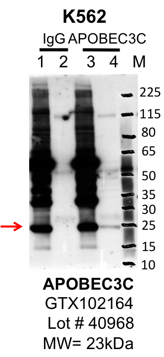 k562_genetex_GTX102164_40968_APOBEC3C.png<br>Caption: IP-Western Blot analysis of K562 whole cell lysate using APOBEC3C specific antibody. Lane 1 is 1% of twenty million whole cell lysate input and lane 2 is 10% of IP enrichment using rabbit normal IgG (lanes under 'IgG'). Lane 3 is 1% of twenty million whole cell lysate input and lane 4 is 10% IP enrichment using rabbit polyclonal Anti-APOBEC3C antibody (lanes under 'APOBEC3C'). This antibody passes preliminary validation and will be further pursued for primary and secondary validation