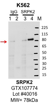 k562_genetex_GTX107774_40016_SRPK2.jpg<br>Caption: IP-Western Blot analysis of K562 whole cell lysate using SRPK2 specific antibody. Lane 1 is 1% of twenty million whole cell lysate input and lane 2 is 10% of IP enrichment using rabbit normal IgG (lanes under 'IgG'). Lane 3 is 1% of twenty million whole cell lysate input and lane 4 is 10% IP enrichment using rabbit polyclonal Anti-SRPK2 pAb antibody (lanes under 'SRPK2').