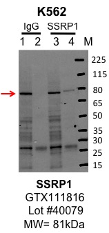 k562_genetex_GTX111816_40079_SSRP1.jpg<br>Caption: IP-Western Blot analysis of K562 whole cell lysate using SSRP1 specific antibody. Lane 1 is 1% of twenty million whole cell lysate input and lane 2 is 10% of IP enrichment using rabbit normal IgG (lanes under 'IgG'). Lane 3 is 1% of twenty million whole cell lysate input and lane 4 is 10% IP enrichment using rabbit polyclonal Anti-SSRP1 pAb antibody (lanes under 'SSRP1').