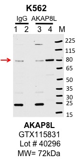 k562_genetex_GTX115831_40296_AKAP8L.jpg<br>Caption: IP-Western Blot analysis of K562 whole cell lysate using AKAP8L specific antibody. Lane 1 is 1% of twenty million whole cell lysate input and lane 2 is 10% of IP enrichment using rabbit normal IgG (lanes under 'IgG'). Lane 3 is 1% of twenty million whole cell lysate input and lane 4 is 10% IP enrichment using rabbit polyclonal AKAP8L antibody [N1N3] (lanes under 'AKAP8L').