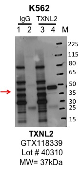 k562_genetex_GTX118339_40310_TXNL2.jpg<br>Caption: IP-Western Blot analysis of K562 whole cell lysate using GLRX3/TXNL2 specific antibody. Lane 1 is 1% of twenty million whole cell lysate input and lane 2 is 10% of IP enrichment using rabbit normal IgG (lanes under 'IgG'). Lane 3 is 1% of twenty million whole cell lysate input and lane 4 is 10% IP enrichment using rabbit polyclonal TXNL2 [N2C3] antibody (lanes under 'TXNL2').